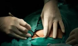 刨腹产视频,直观呈现母婴安全守护